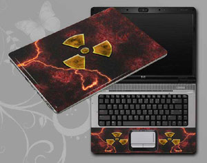 Radiation Laptop decal Skin for ACER Aspire E5-721-625Z 10157-115-Pattern ID:115